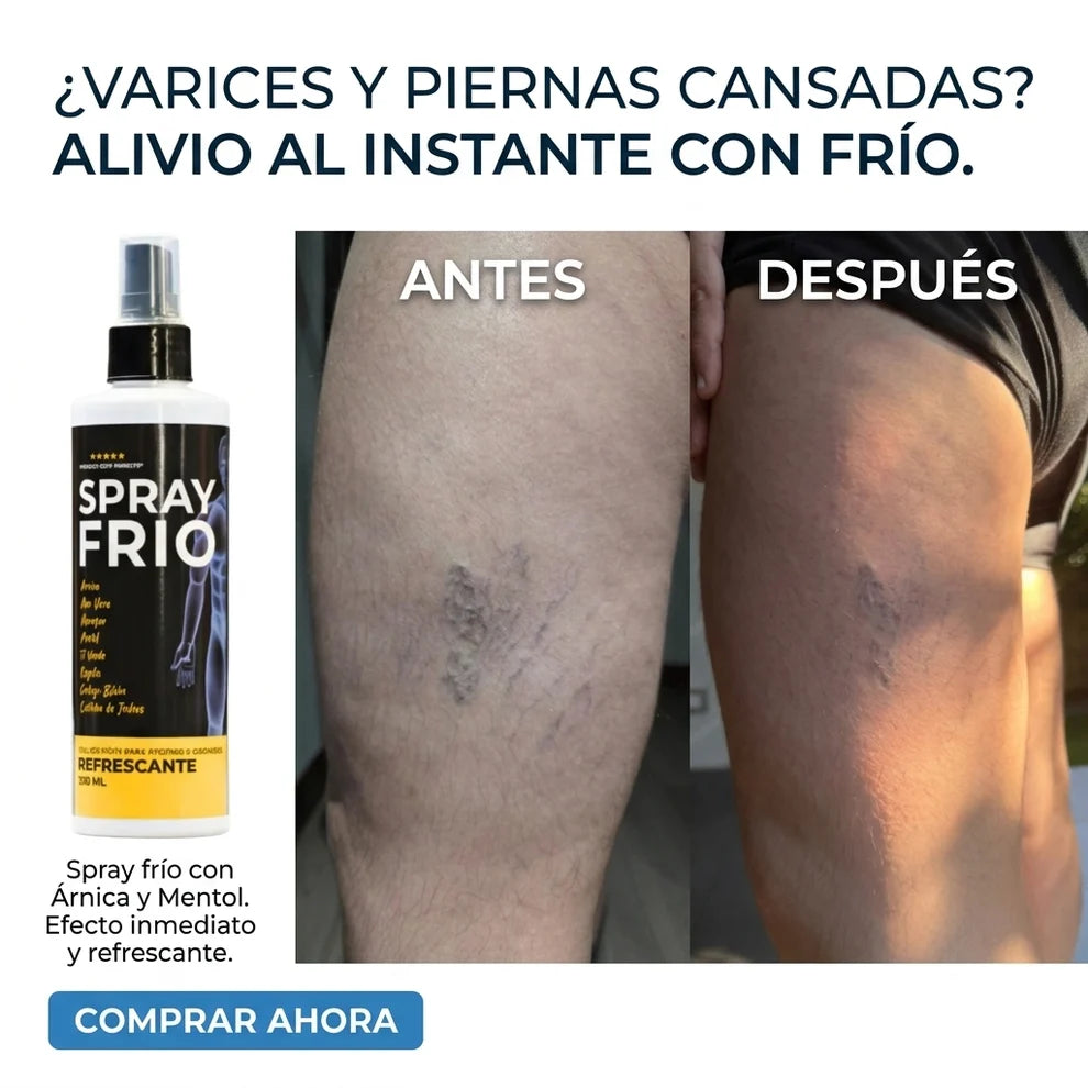 Spray Frio Muscular | para molestias musculares y articulares.